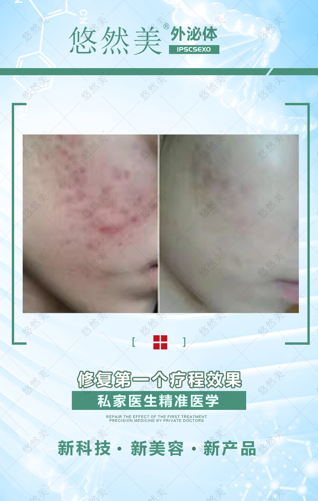 外泌體有什么功效與作用，正規(guī)嗎   來看一下部分案例