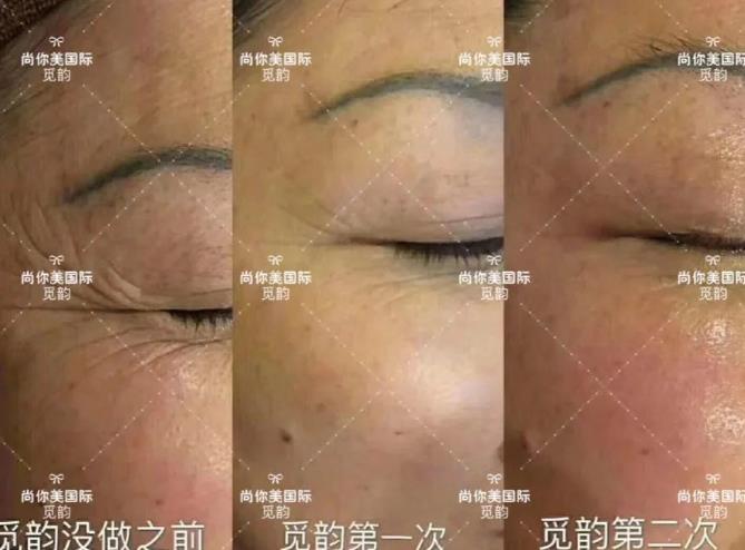 美容院拓客套盒方法，眼部面部身體拓客套盒話術(shù)