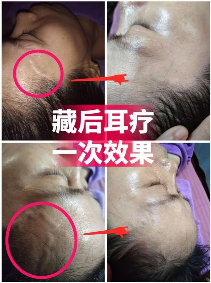 尤其適宜虛寒癥和痛癥、痹癥的人群