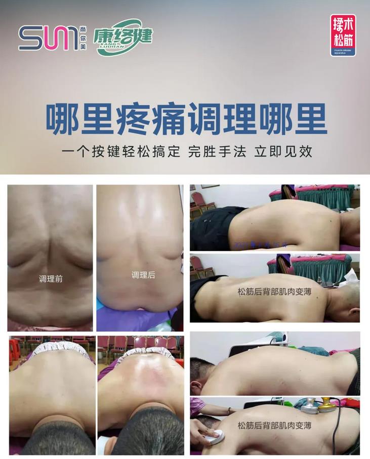 腰肌勞損、盆腔寒濕淤毒及臀肌勞損等病例一次體現當場見效